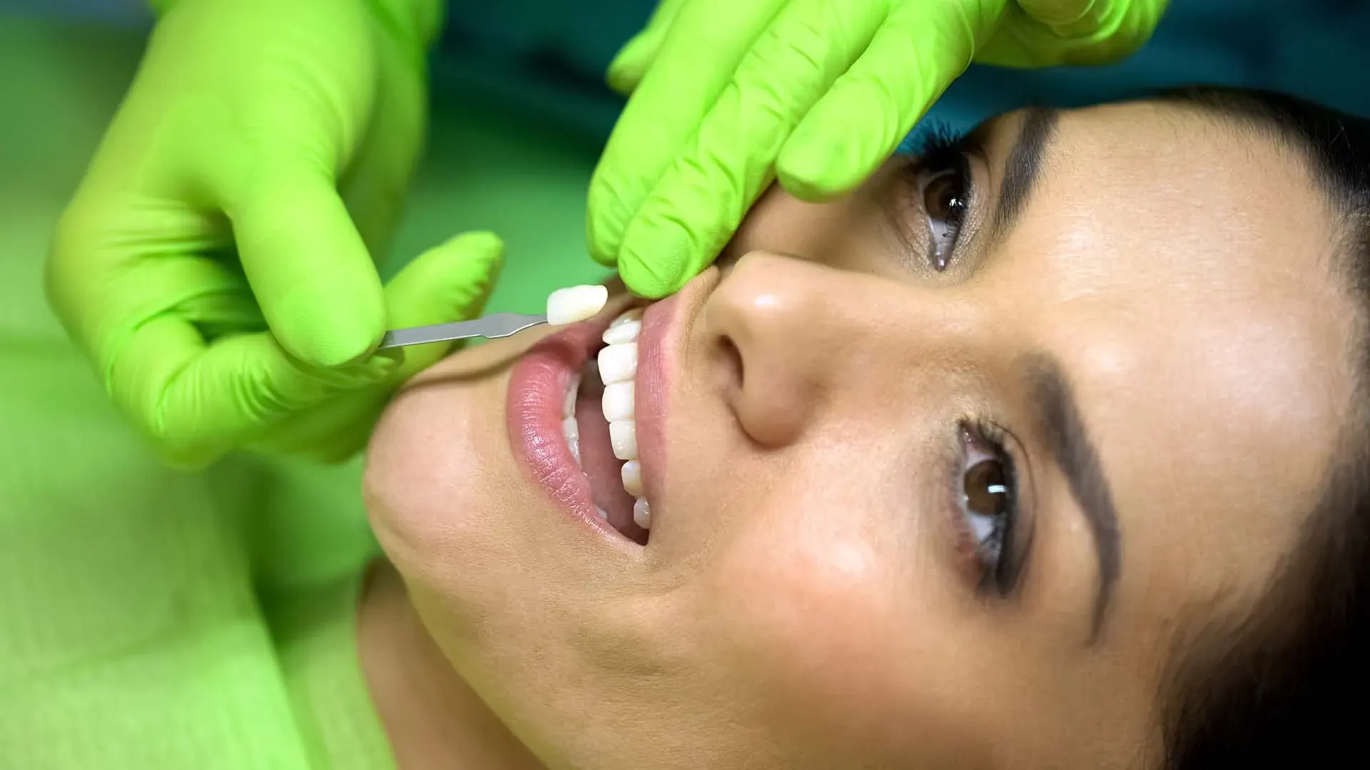 SureSmile & Clear Aligners at Clark Dental
