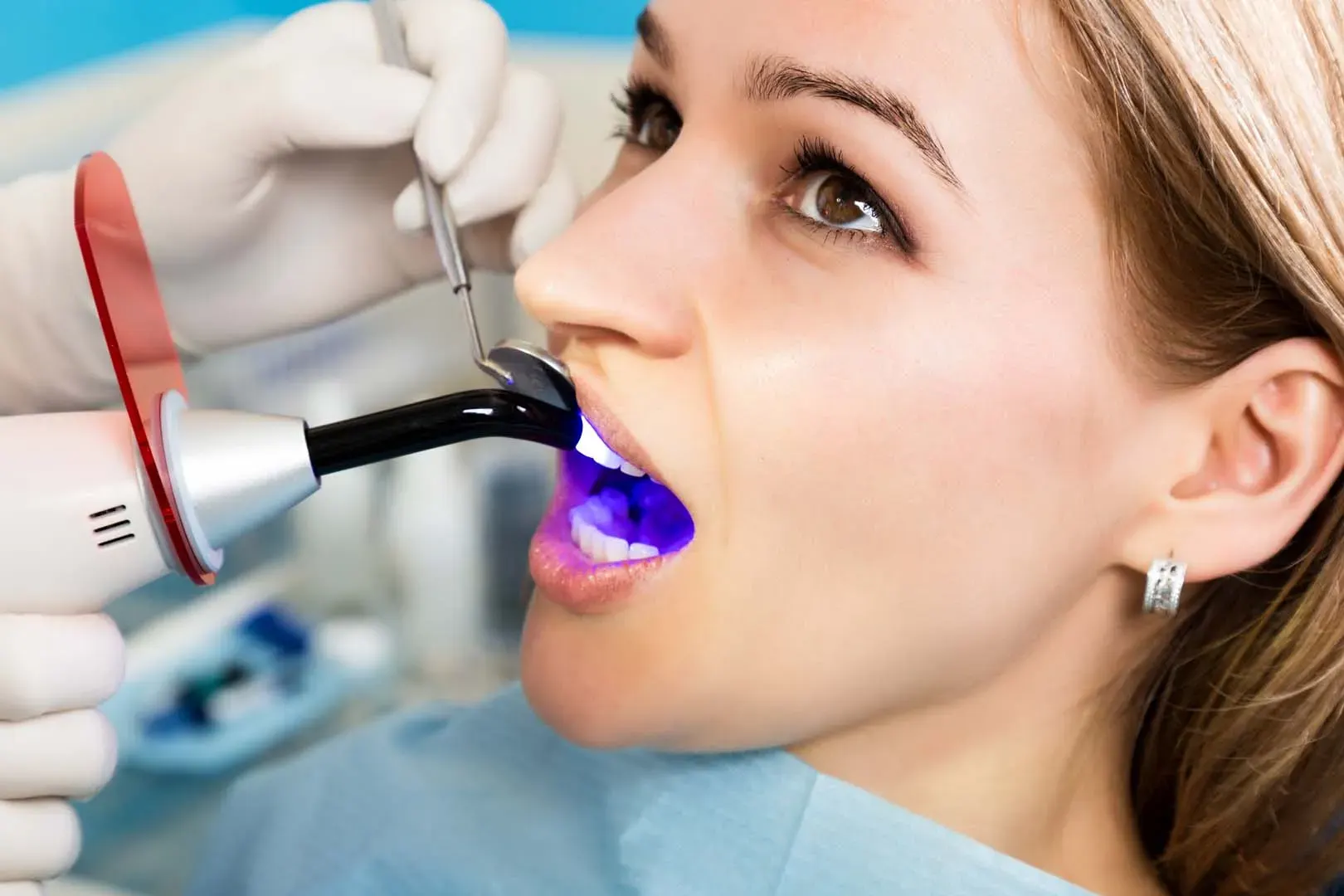 Dental Fillings at Clark Dental