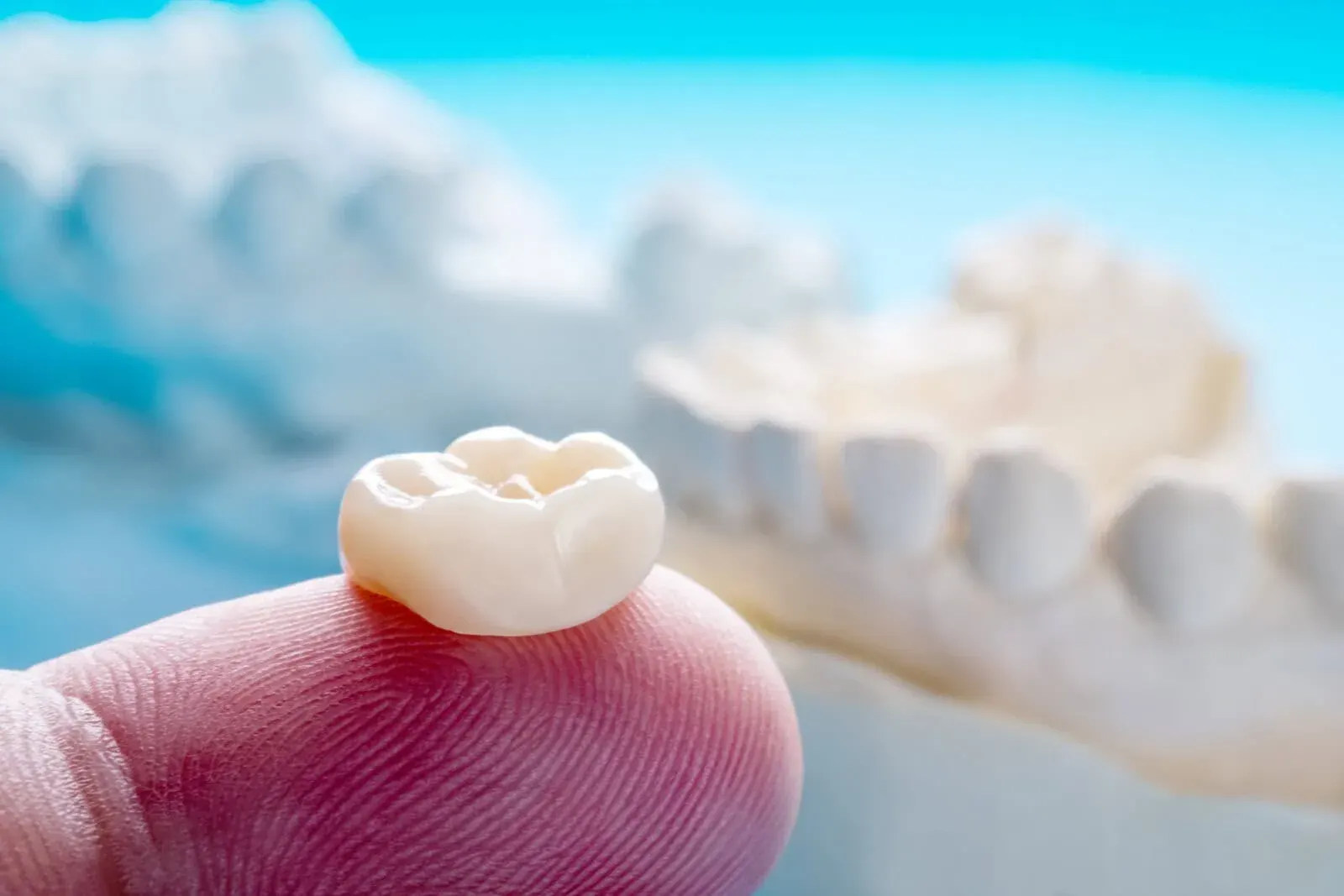 Crowns at Clark Dental