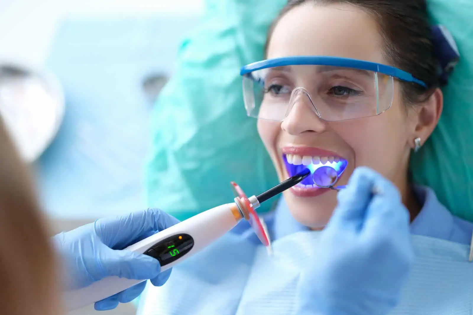Dental Bonding at Clark Dental